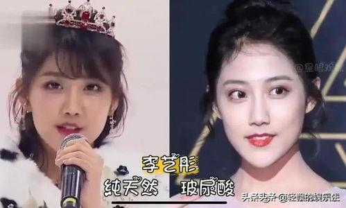 明星打玻尿酸对比照片